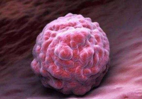 睾丸扭转一定要及时治疗，附最齐全的治疗方法及流程