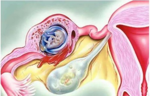 2023温岭中医院试管婴儿科普知识导航，一文了解助孕成功率多少
